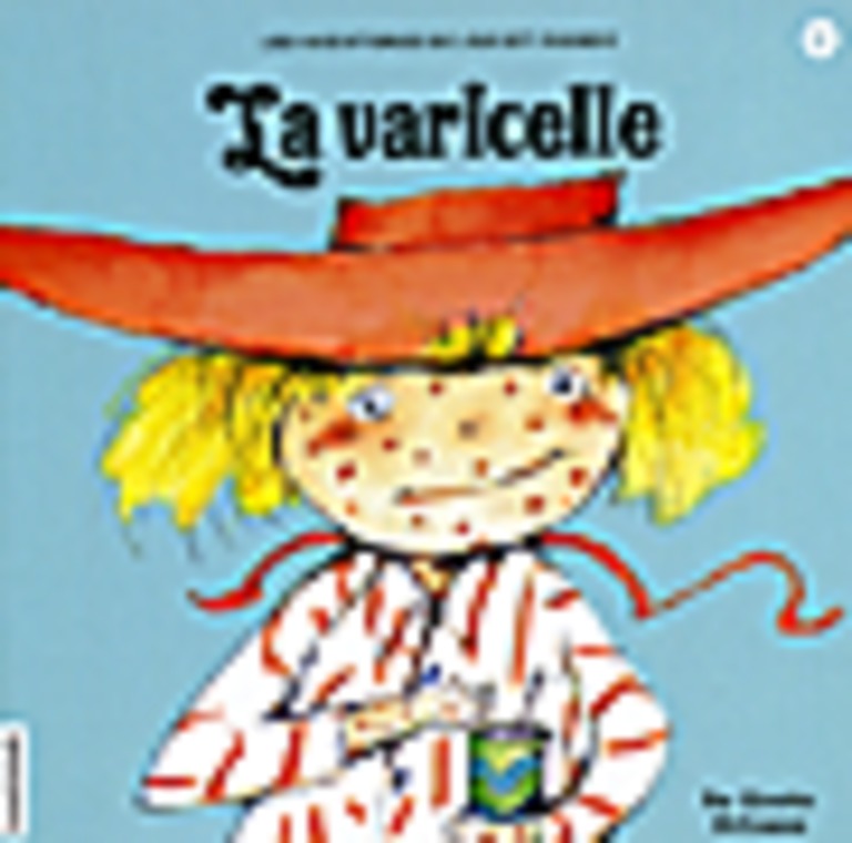 La varicelle